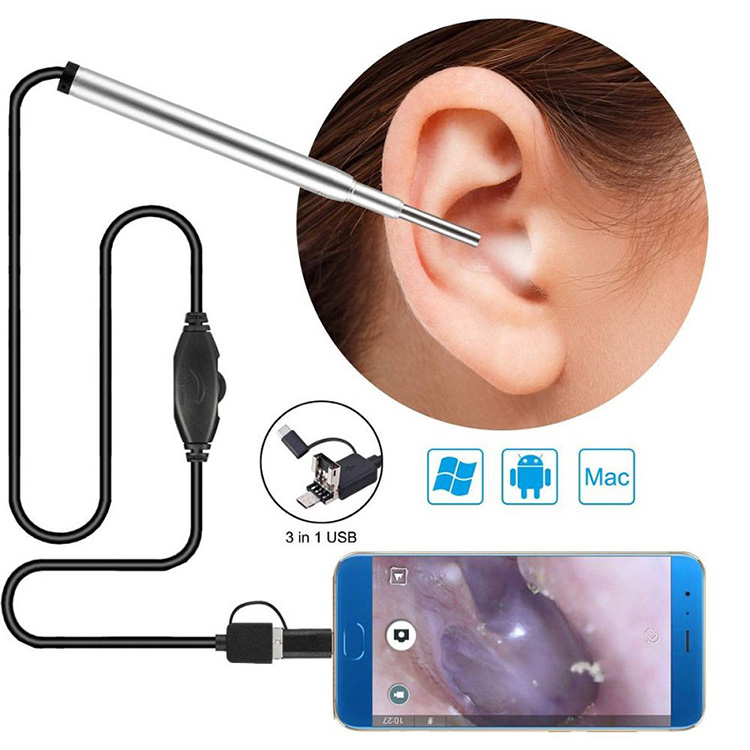 Medical Endoscope Camera Sofina Nasal Endoscope Usb Otoscope